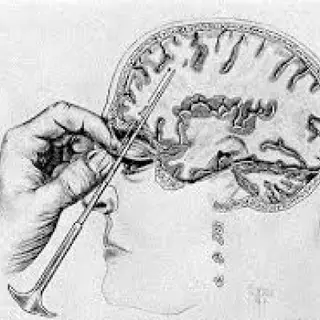Lobotomy Archive