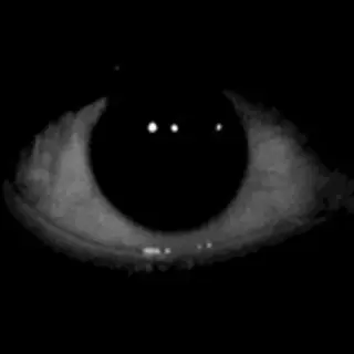 The eye block