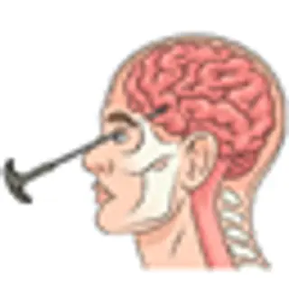 Instant Lobotomy But on bedrock