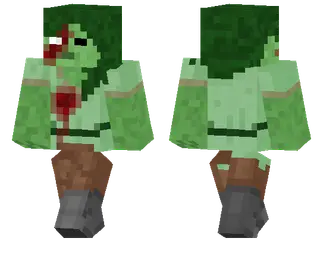Alex Zombie Skin